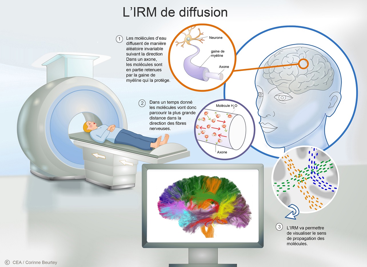 Découvrir Comprendre L imagerie médicale